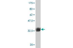 Western Blot detection against Immunogen (37.