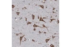Immunohistochemical staining of human cerebral cortex with CTAGE5 polyclonal antibody  shows strong cytoplasmic positivity in neuronal cells. (MIA2 anticorps  (AA 392-507))