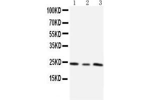 Anti-TIMP4 antibody, Western blotting Lane 1: HT1080 Cell Lysate Lane 2: HELA Cell Lysate Lane 3: SMMC Cell Lysate (TIMP4 anticorps  (C-Term))