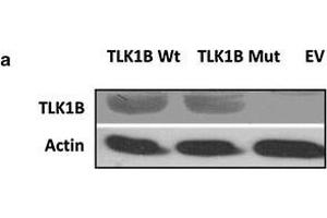 a Overexpression of Wt TLK1B and Mut TLK1B in stably transfected HEK293 cells. (TLK1 anticorps)