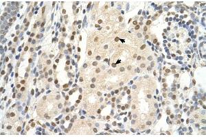 Rabbit Anti-PUF60 Antibody  Paraffin Embedded Tissue: Human Kidney Cellular Data: Epithelial cells of renal tubule Antibody Concentration: 4. (PUF60 anticorps  (C-Term))