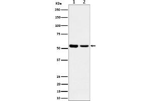 Western blot analysis of AAMP expression in (1) A375 lysate, (2) MCF7 cell lysate.