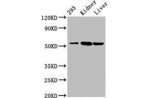 Western Blot Positive WB detected in: 293 whole cell lysate, Mouse kidney tissue, Mouse liver tissue All lanes: DBT antibody at 4. (DBT anticorps  (AA 140-259))