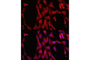 Immunofluorescence analysis of NIH/3T3 cells using LDHA Rabbit mAb  at dilution of 1:100 (40x lens). (Lactate Dehydrogenase A anticorps)