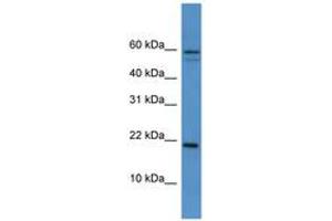 Image no. 1 for anti-Heat Shock 27kDa Protein Family, Member 7 (Cardiovascular) (HSPB7) (AA 51-100) antibody (ABIN6746091) (HSPB7 anticorps  (AA 51-100))