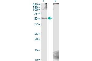 Western Blot analysis of ZWILCH expression in transfected 293T cell line by ZWILCH monoclonal antibody (M11), clone 1C10. (ZWILCH anticorps  (AA 1-477))