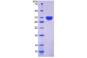 SDS-PAGE analysis of Rat DKC Protein. (DKC1 Protéine)
