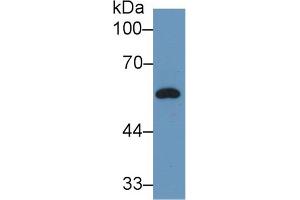 Western Blot; Sample: Rat Plasma; Primary Ab: 2µg/ml Rabbit Anti-Rat DBP Antibody Second Ab: 0. (Vitamin D-Binding Protein anticorps  (AA 209-394))