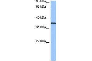 WB Suggested Anti-HNRNPA2B1 Antibody Titration:  0. (HNRNPA2B1 anticorps  (N-Term))