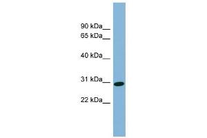 CENPQ antibody used at 1 ug/ml to detect target protein. (CENPQ anticorps  (N-Term))