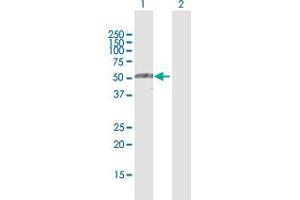 Western Blot analysis of TRIM35 expression in transfected 293T cell line by TRIM35 MaxPab polyclonal antibody. (TRIM35 anticorps  (AA 1-493))
