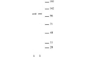STAT2 antibody (pAb) tested by Immunoprecipitation. (STAT2 anticorps  (C-Term))