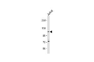 Anti-PKN1 Antibody (C-Term) at 1:2000 dilution + Jurkat whole cell lysate Lysates/proteins at 20 μg per lane. (PKN1 anticorps  (AA 836-870))