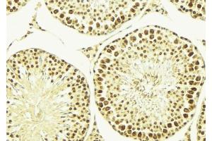 ABIN6269353 at 1/100 staining Mouse testis tissue by IHC-P. (HDAC1 anticorps  (C-Term))