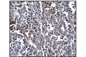 Immunohistochemistry (IHC) image for anti-ORAI Calcium Release-Activated Calcium Modulator 1 (ORAI1) (C-Term) antibody (ABIN492545)