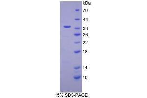 SDS-PAGE (SDS) image for Retinol Binding Protein 3, Interstitial (RBP3) (AA 19-320) protein (His tag) (ABIN1080640)