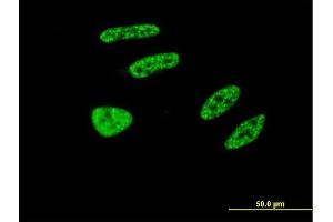 Immunofluorescence of monoclonal antibody to TRIM32 on HeLa cell.
