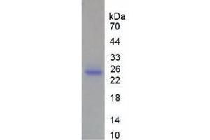 SDS-PAGE analysis of Human MMP13 Protein.