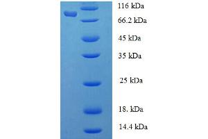 SDS-PAGE (SDS) image for Phenylalanyl-tRNA Synthetase, alpha Subunit (FARSA) (AA 2-508) protein (His-SUMO Tag) (ABIN5712009)