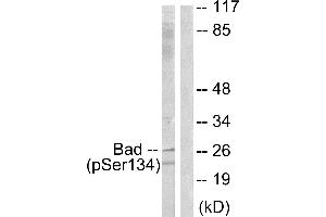 Immunohistochemistry analysis of paraffin-embedded human brain tissue using BAD (Phospho-Ser134) antibody.