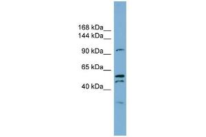 Anoctamin 6 antibody used at 1 ug/ml to detect target protein. (Anoctamin 6 anticorps  (Middle Region))