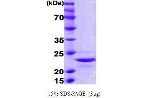 SDS-PAGE (SDS) image for Interleukin 1, beta (IL1B) (AA 113-271) protein (His tag) (ABIN5855196) (IL-1 beta Protein (AA 113-271) (His tag))