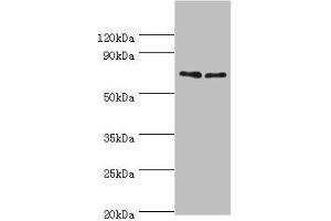 Western blot All lanes: TNFRSF21 antibody at 4 μg/mL Lane 1: K562 whole cell lysate Lane 2: Jurkat whole cell lysate Secondary Goat polyclonal to rabbit IgG at 1/10000 dilution Predicted band size: 72 kDa Observed band size: 72 kDa (TNFRSF21 anticorps  (AA 371-655))