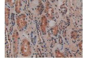 IHC-P analysis of Human Kidney Tissue, with DAB staining. (Osteopontin anticorps  (AA 17-287))