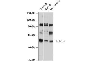 Western blot analysis of extracts of various cell lines, using ERO1LB antibody (ABIN6132192, ABIN6140294, ABIN6140295 and ABIN6220326) at 1:1000 dilution. (ERO1LB anticorps  (AA 34-230))