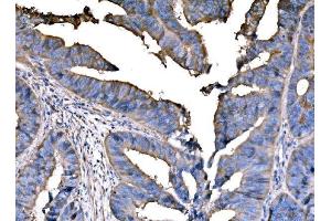 IHC analysis of PPFIA1 using anti-PPFIA1 antibody (ABIN7600454).