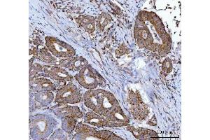 IHC analysis of MFF using anti-MFF antibody (ABIN7599292). (MFF anticorps  (AA 1-342))