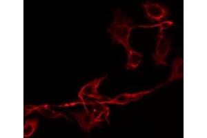 ABIN6275773 staining HepG2 by IF/ICC.