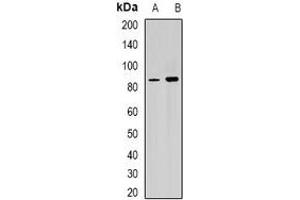 Western blot analysis of RPGR expression in Y79 (A), mouse heart (B) whole cell lysates. (RPGR anticorps)