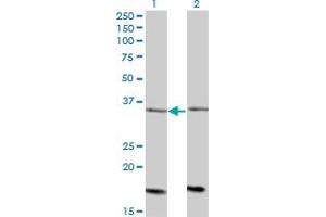 Western Blot analysis of ADCK4 expression in transfected 293T cell line by ADCK4 monoclonal antibody (M01), clone 1D9.