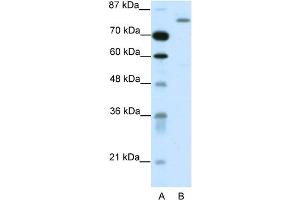 WB Suggested Anti-TRIM28 Antibody Titration:  1. (KAP1 anticorps  (C-Term))