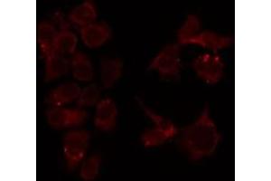 ABIN6276763 staining HeLa by IF/ICC. (MUTYH anticorps  (Internal Region))