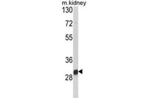 Western blot analysis of NAT2 Antibody (C-term) in mouse kidney tissue lysates (35ug/lane). (NAT2 anticorps  (C-Term))