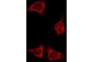 ABIN6275883 staining HeLa by IF/ICC. (IL4I1 anticorps  (N-Term))