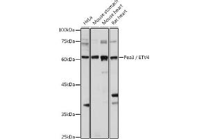Western blot analysis of extracts of various cell lines, using Pea3 / ETV4 antibody (ABIN6131217, ABIN6140332, ABIN6140334 and ABIN6221480) at 1:1000 dilution.