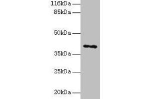 Western blot All lanes: MAGEA10 antibody at 2 μg/mL + HL60 whole cell lysate Secondary Goat polyclonal to rabbit IgG at 1/10000 dilution Predicted band size: 41 kDa Observed band size: 41 kDa (MAGEA1 anticorps  (AA 2-225))