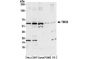 anti-Tubulin Folding Cofactor E (TBCE) (AA 25-75) antibody