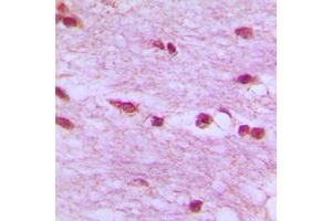 Immunohistochemical analysis of Lamin B1 staining in human brain formalin fixed paraffin embedded tissue section. (Lamin B1 anticorps  (N-Term))