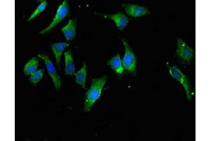 Immunofluorescent analysis of Hela cells using ABIN7152180 at dilution of 1:100 and Alexa Fluor 488-congugated AffiniPure Goat Anti-Rabbit IgG(H+L)