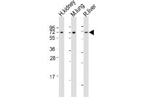 All lanes : Anti-ACSF2 Antibody (Center) at 1:2000 dilution Lane 1: human kidney lysates Lane 2: mouse lung lysates Lane 3: rat liver lysates Lysates/proteins at 20 μg per lane. (ACSF2 anticorps  (AA 198-232))
