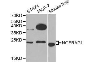 Western blot analysis of extracts of various cell lines, using NGFRAP1 Antibody (ABIN5974398) at 1/1000 dilution. (Nerve Growth Factor Receptor (TNFRSF16) Associated Protein 1 (NGFRAP1) anticorps)