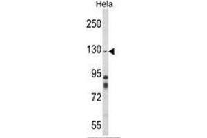 Western blot analysis of ITGA1 Antibody (Center) in Hela cell line lysates (35ug/lane). (Integrin alpha 1 anticorps  (Middle Region))