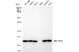 Western blotting analysis using TSPO antibody (ABIN7799775).