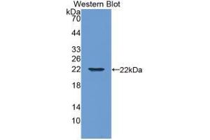 Western blot analysis of the recombinant protein. (Aggrecan anticorps  (AA 34-147))