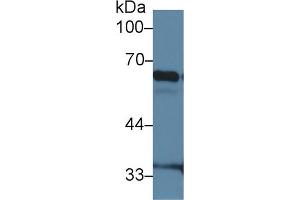 Western Blot; Sample: Mouse Lung lysate; Primary Ab: 2µg/ml Rabbit Anti-Mouse IkBz Antibody Second Ab: 0. (Inhibitory Subunit of NF-KappaB zeta (AA 414-654) anticorps)