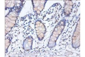 Immunohistochemistry of paraffin-embedded human small intestine tissue using ABIN7155104 at dilution of 1:100 (HNRNPD/AUF1 anticorps  (AA 18-355))